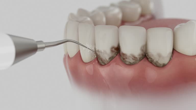 Trusted Tooth Extraction service in Ham Lake, MN - Dentist Open Now